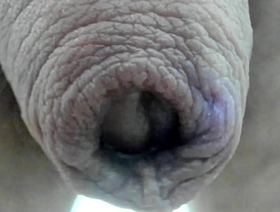 My foreskin superclose :)